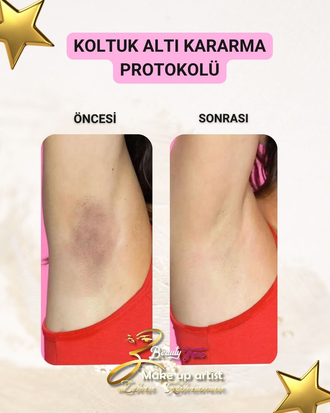 İşlem sonrası